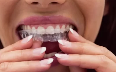 Invisalign Lawndale: Clear Aligner Therapy for Discreet Orthodontic Correction